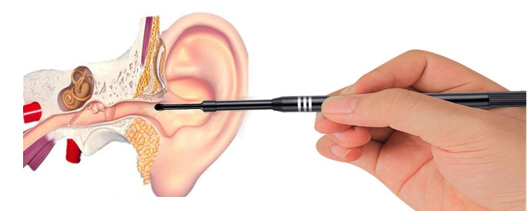 Endoscope Ear Pick